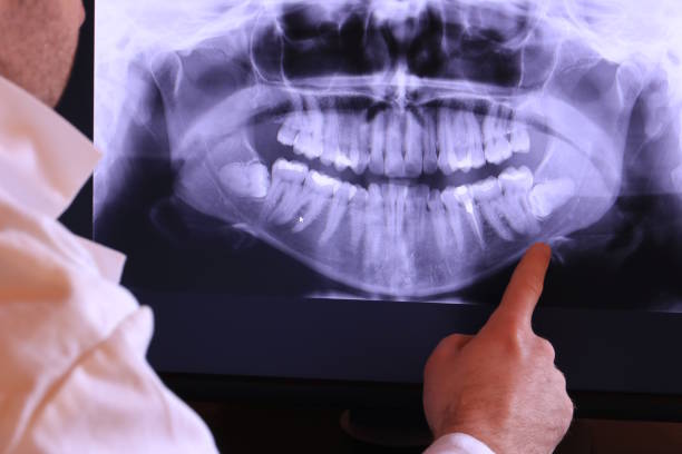 Best Teeth Whitening  in Lino Lakes, MN