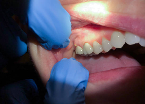 Dentist for Dental Trauma in MN